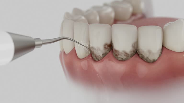 Trusted Dental Crowns And Bridges service in Boulevard Gardens, FL - Dentist Open Now
